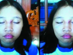Cerita Suram Chika, Siswi SDN Bintara 2 Bekasi yang Dibully dan Disiksa 10 Temannya