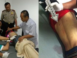 Polisi Buru Komplotan Begal Sadis di Bekasi Utara