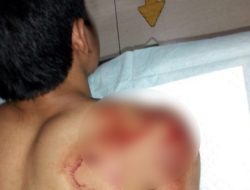 Begal Sadis Bacok Korbannya di Cikarang Selatan, Motor Dibawa Kabur
