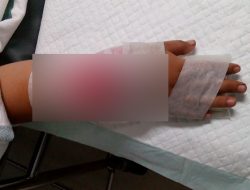 Cerita Perempuan Dibacok saat Naik Motor di Rawalumbu